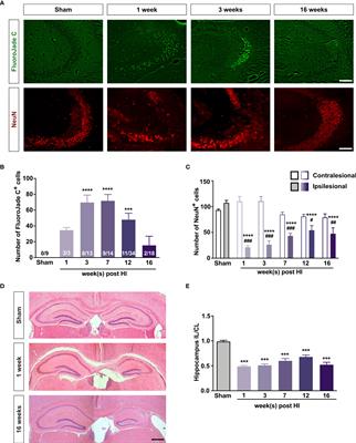 C3a Receptor Signaling Inhibits Neurodegeneration Induced by Neonatal Hypoxic-Ischemic Brain Injury